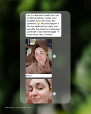 Sun Repair Supplement