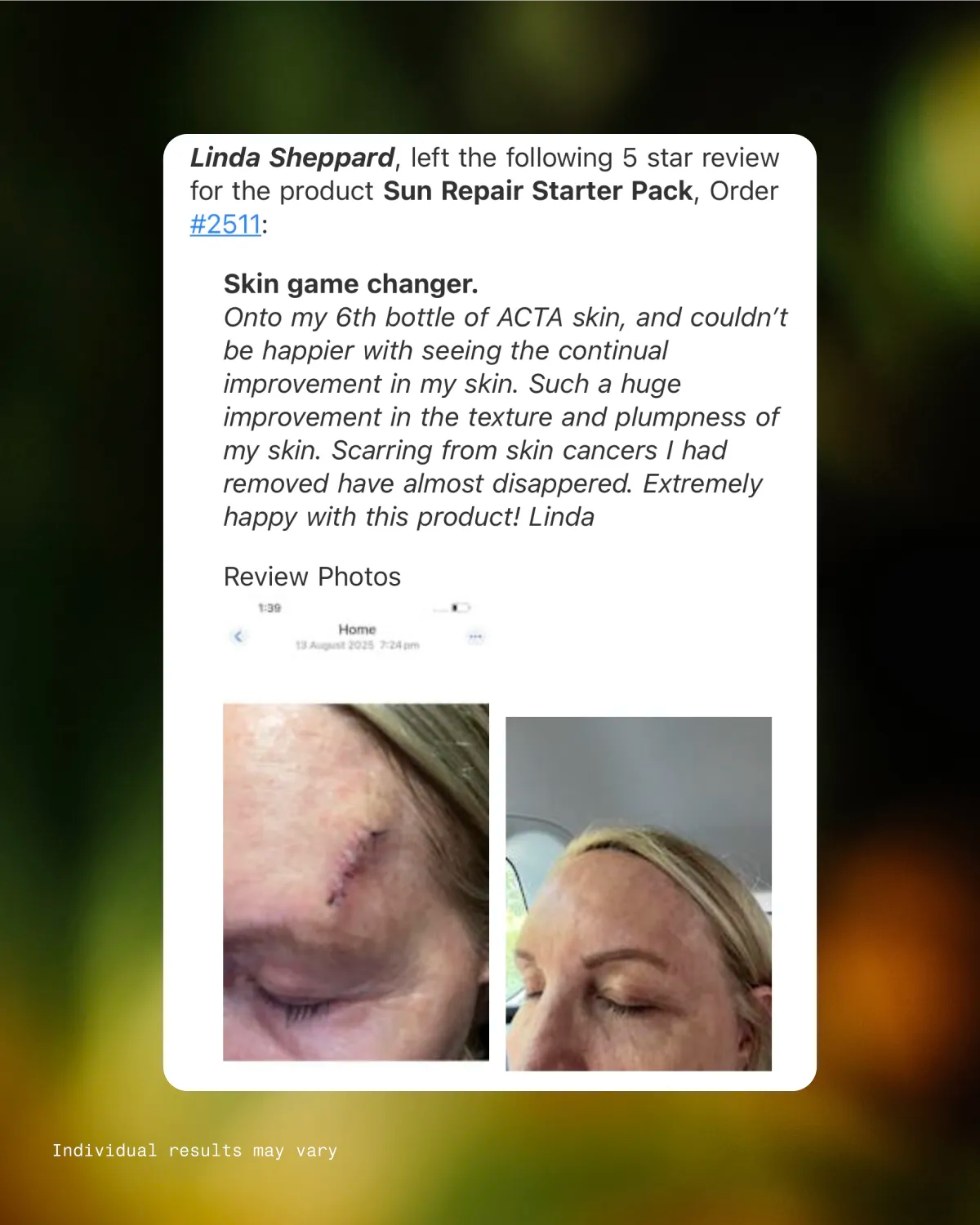 Sun Repair Supplement