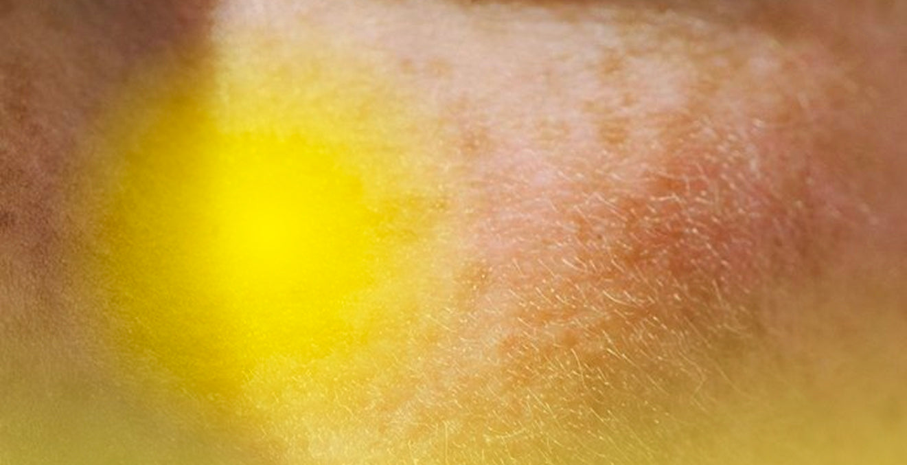 ACTASKIN | Sun Protection & Skin Repair – Actaskin